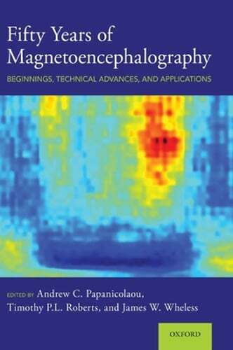 Fifty Years of Magnetoencephalography: Beginnings, Technical Advances, and: Used