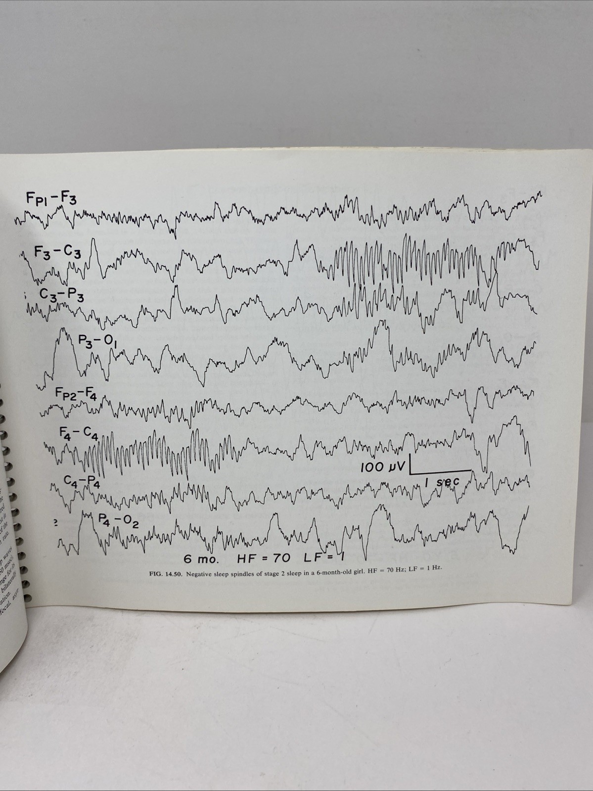 Fundamentals EEG Technology Vol 1 Tyner Spiral Bound 1985 Raven Press Lippincott