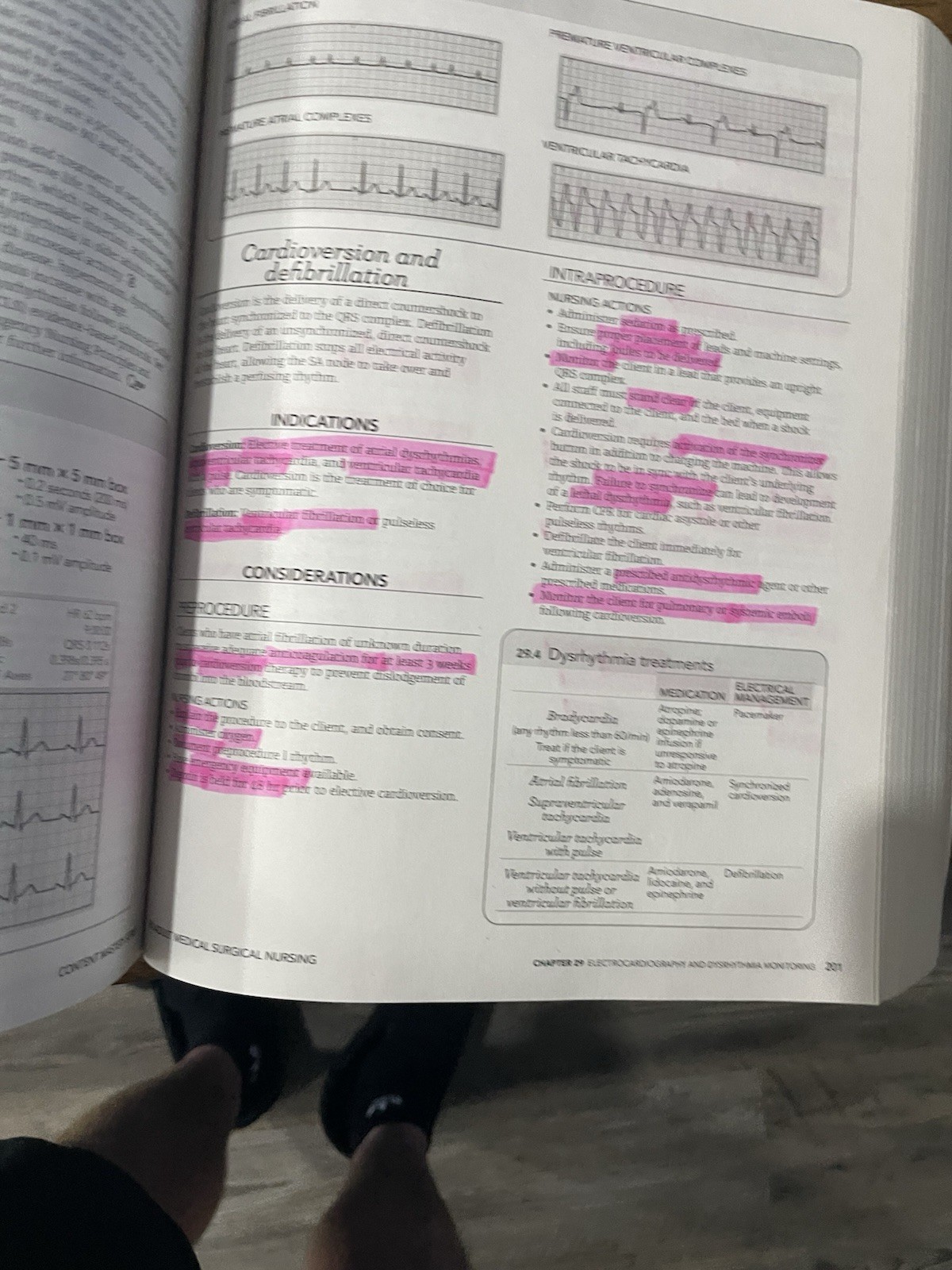 RN Adult Medical Surgical Nursing Edition 12.0 : Content Mastery