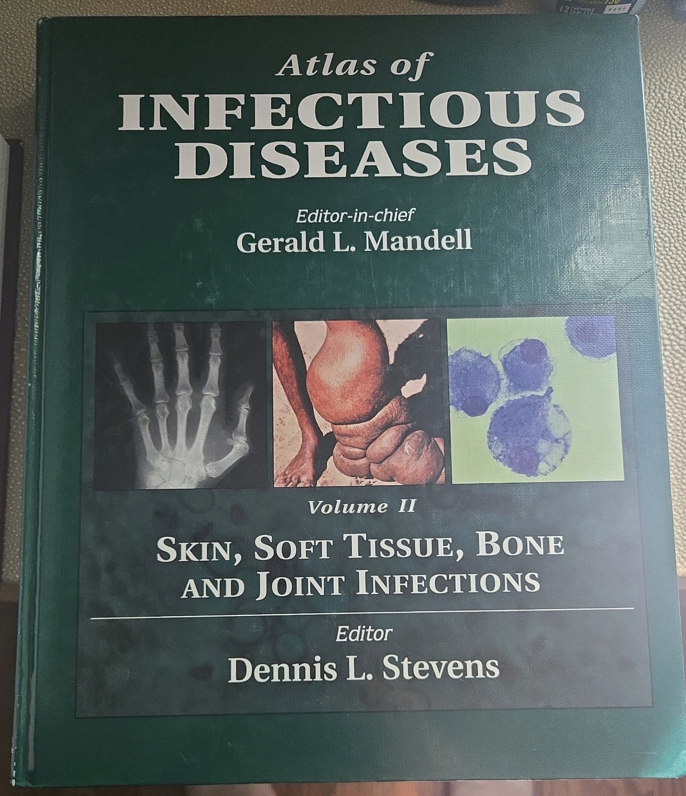 Atlas of Infectious Diseases: Skin, Soft Tissue, Bone and Joint Infections, …