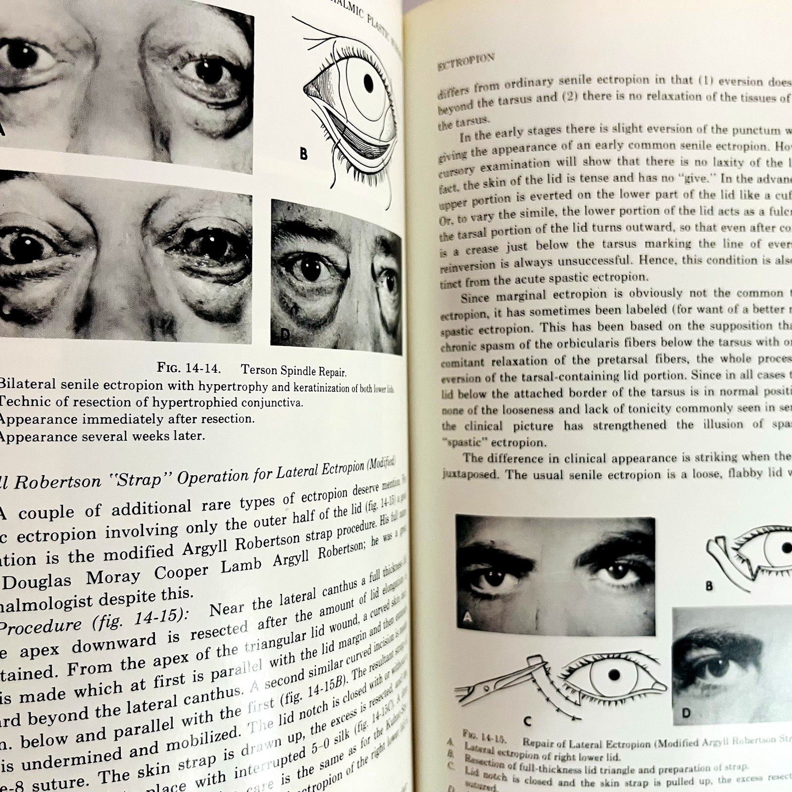 Ophthalmic Plastic Surgery Fifth Edition Book Hardcover Sidney A. Fox 1976