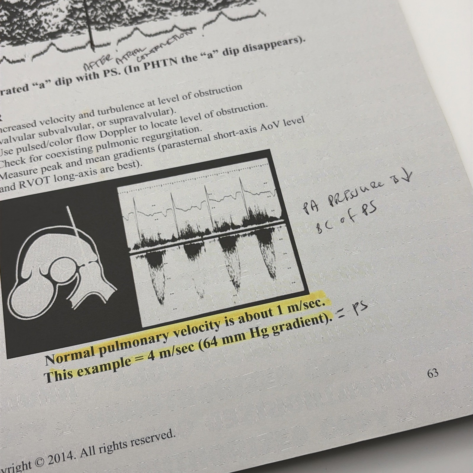 ESP Adult Echocardiography: Education for the Sonographic Professional