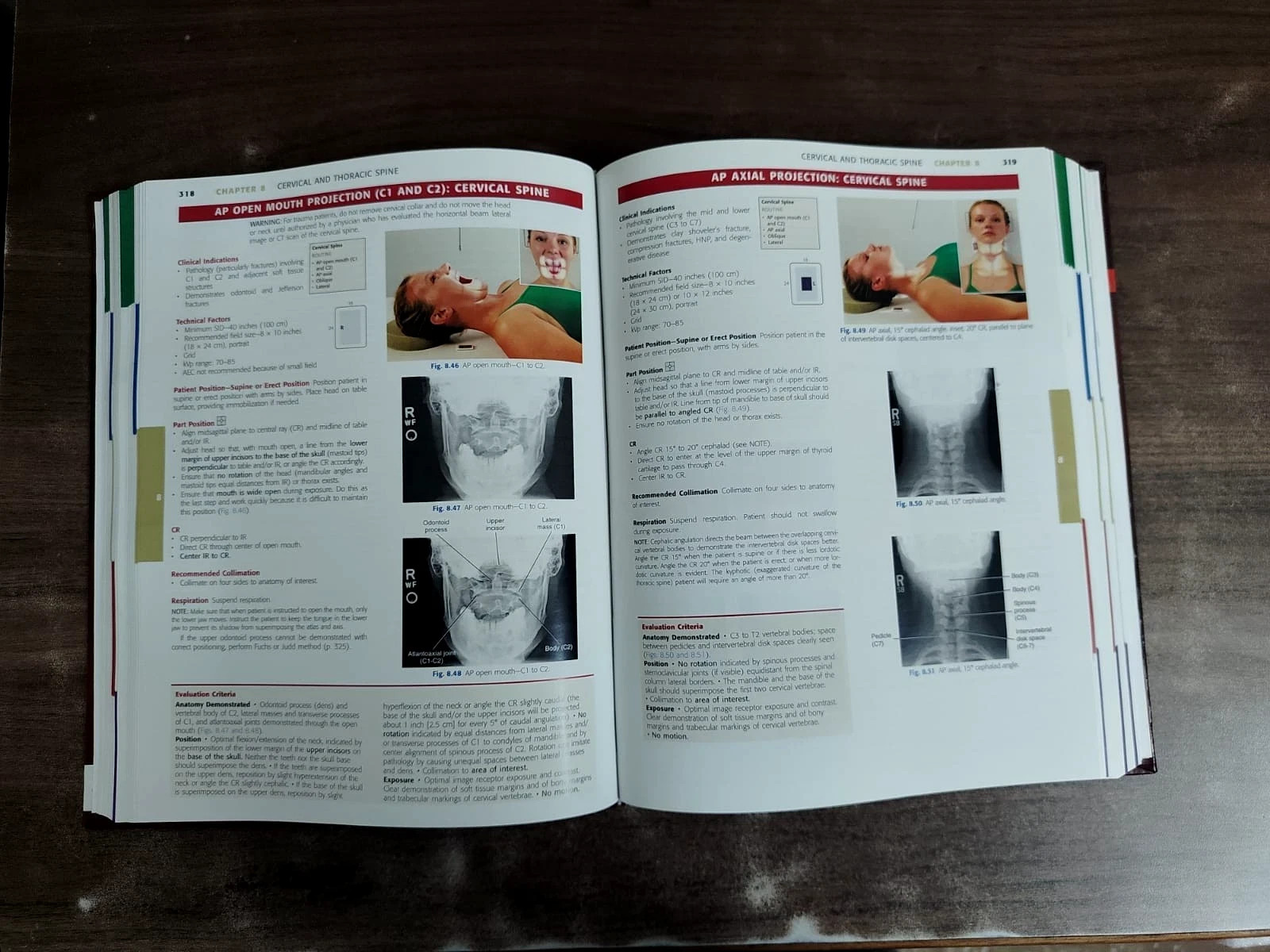 Textbook of Radiographic Positioning and Related Anatomy Hardcover