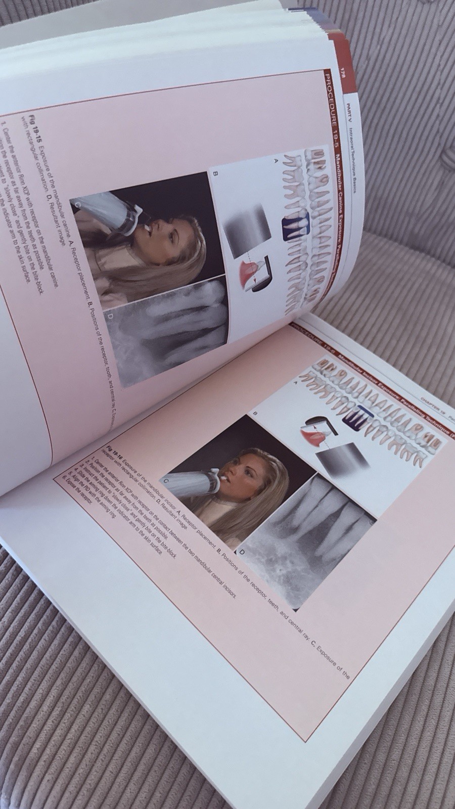 Dental Radiography: Principles & Techniques- Iannucci- 6th Edition