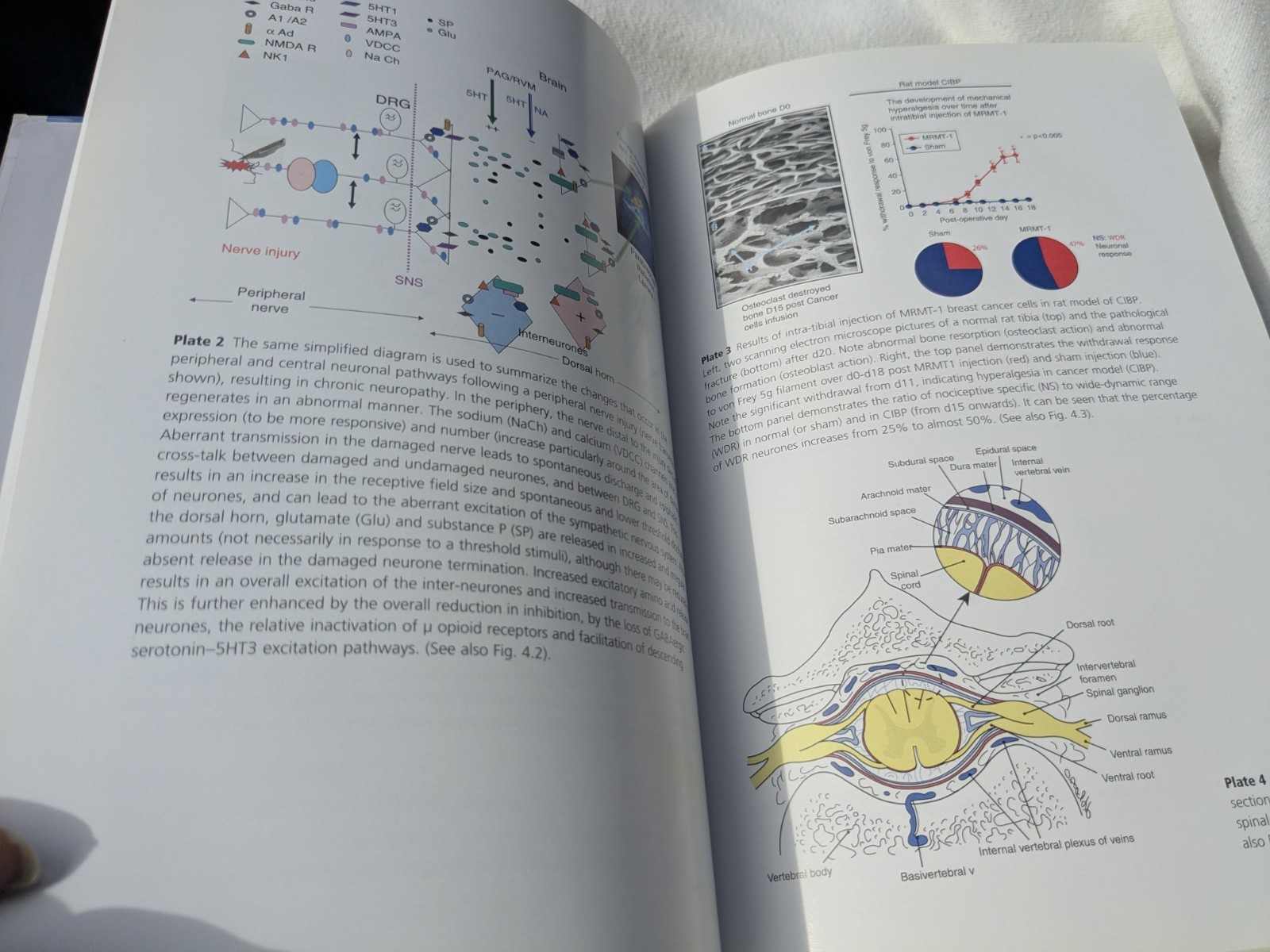 Interventional Pain Control in Cancer Pain Management Oxford Hester Sykes PeatHC