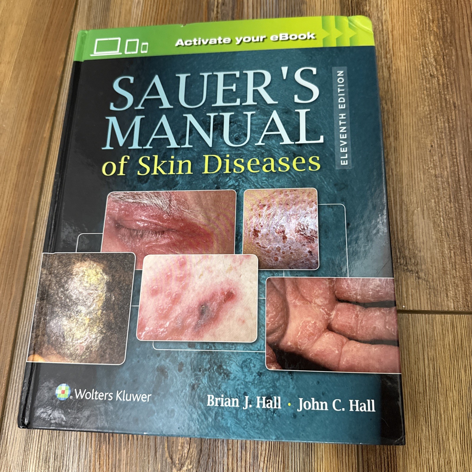 Sauer’s Manual of Skin Diseases 11E Dr. John C. Hall Hardcover