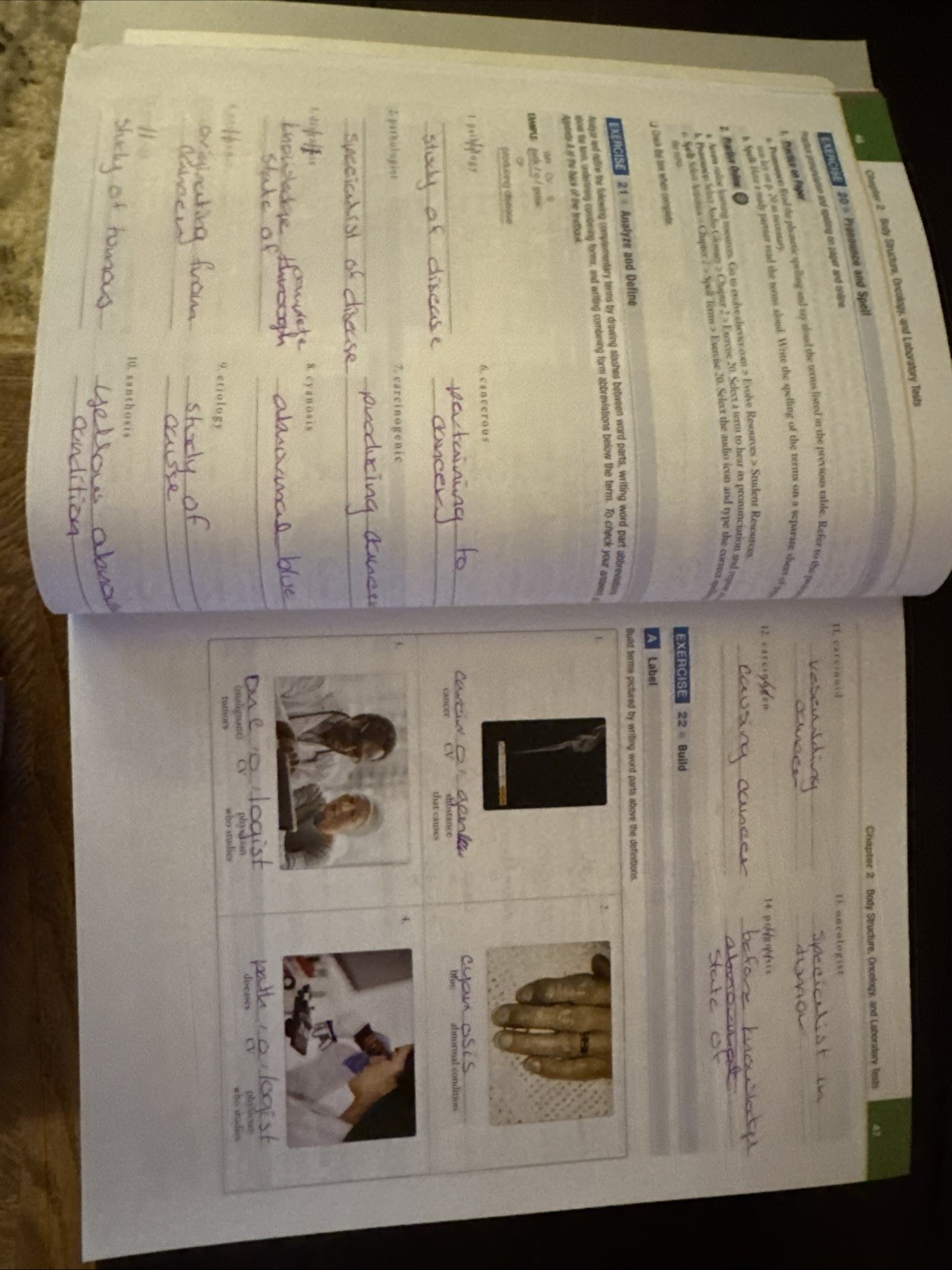 Exploring Medical Language : A Student-Directed Approach