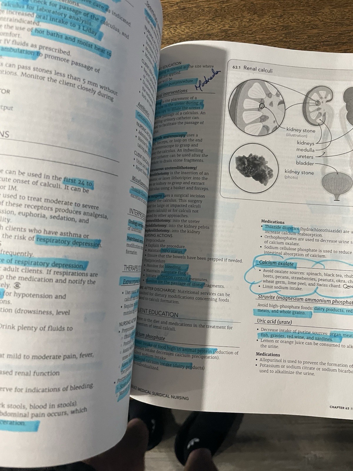 RN Adult Medical Surgical Nursing Edition 12.0 : Content Mastery