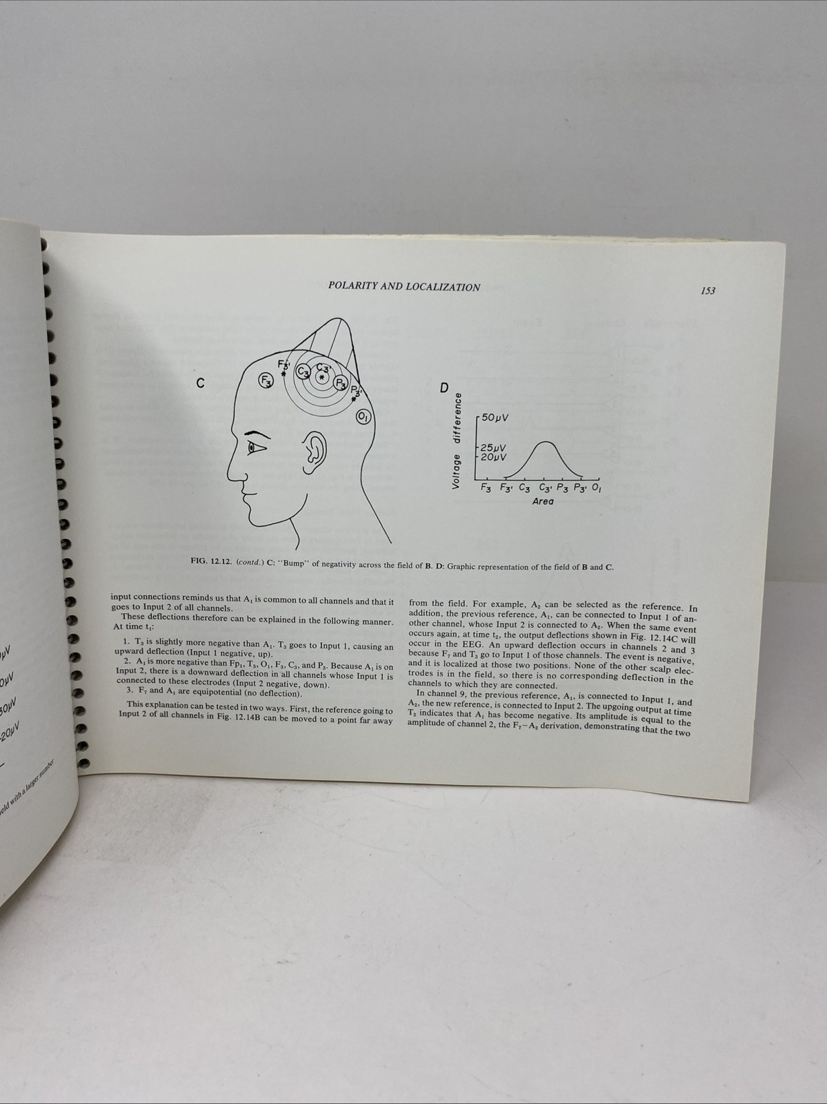 Fundamentals EEG Technology Vol 1 Tyner Spiral Bound 1985 Raven Press Lippincott
