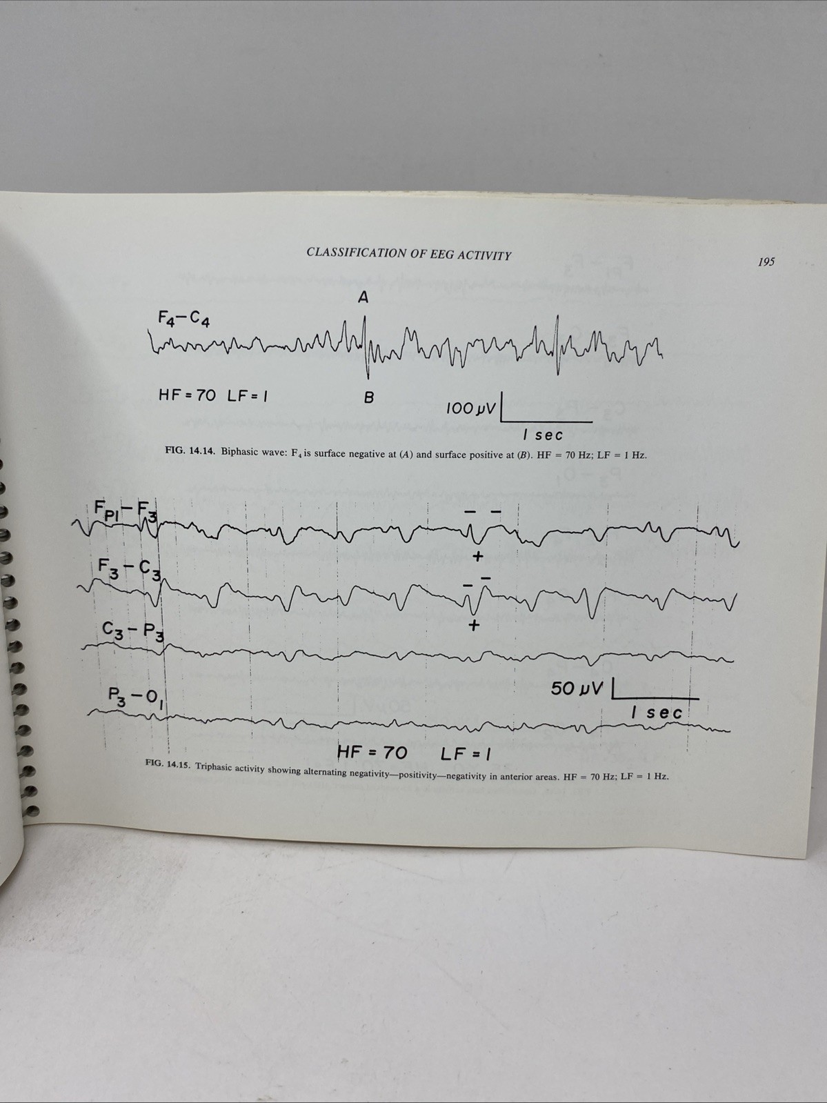 Fundamentals EEG Technology Vol 1 Tyner Spiral Bound 1985 Raven Press Lippincott