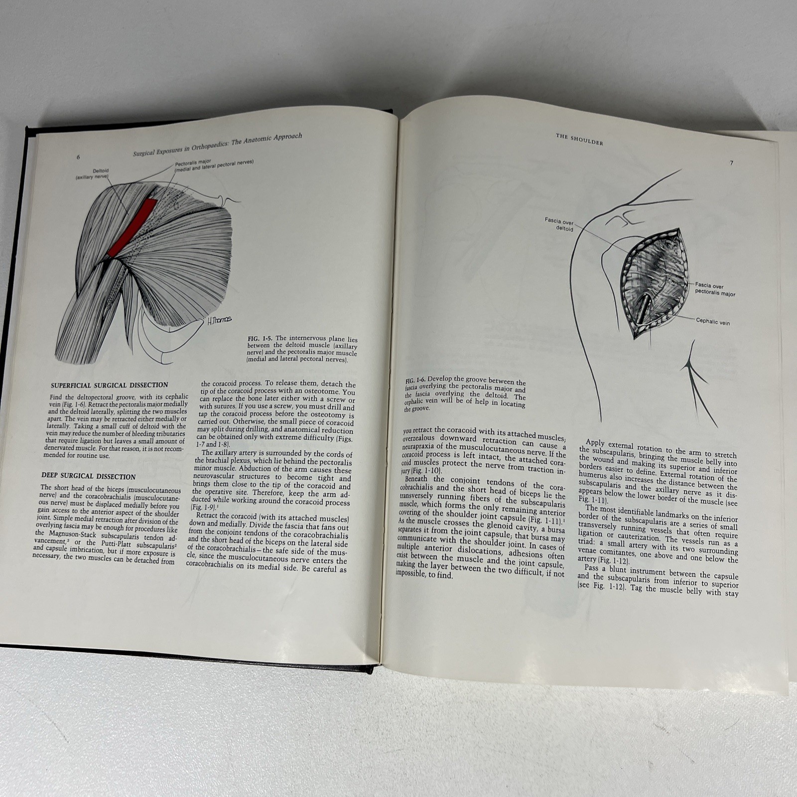 Surgical Exposures in Orthopaedics Hardcover Stanley Hoppenfeld