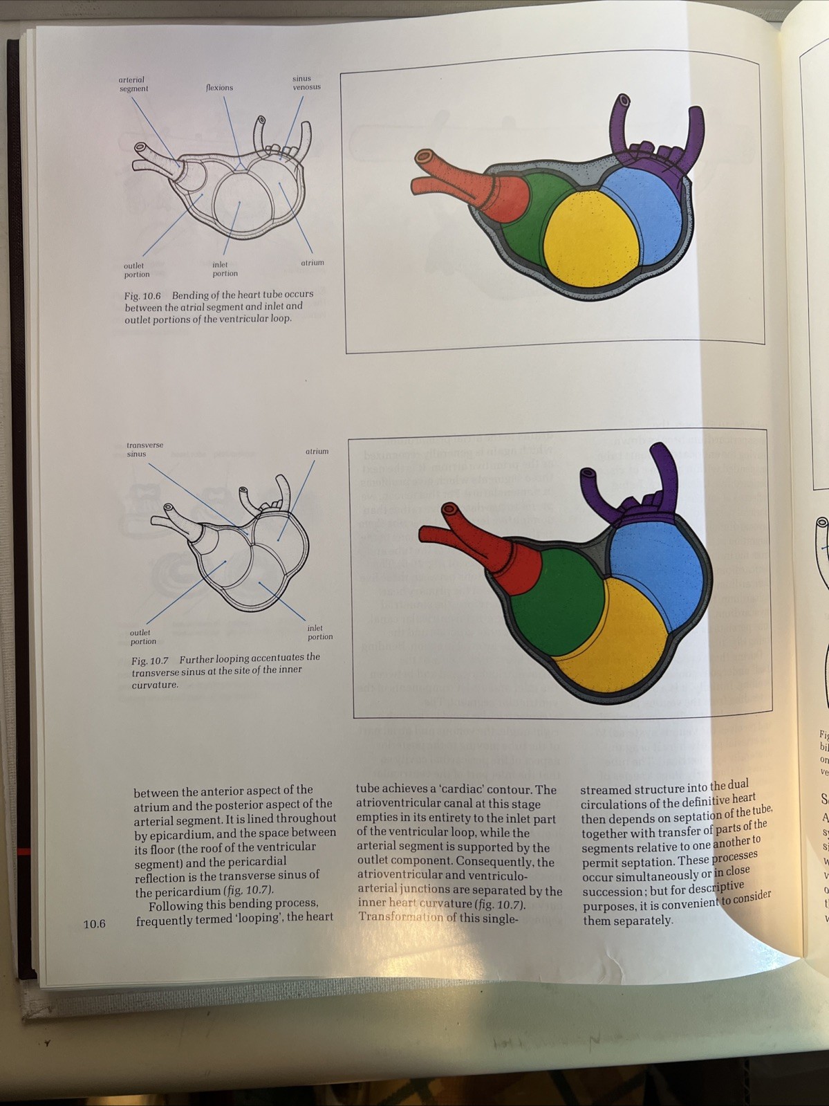 Cardiac Anatomy: An Integrated Text and Color Atlas by Robert Anderson- 1980 -B2