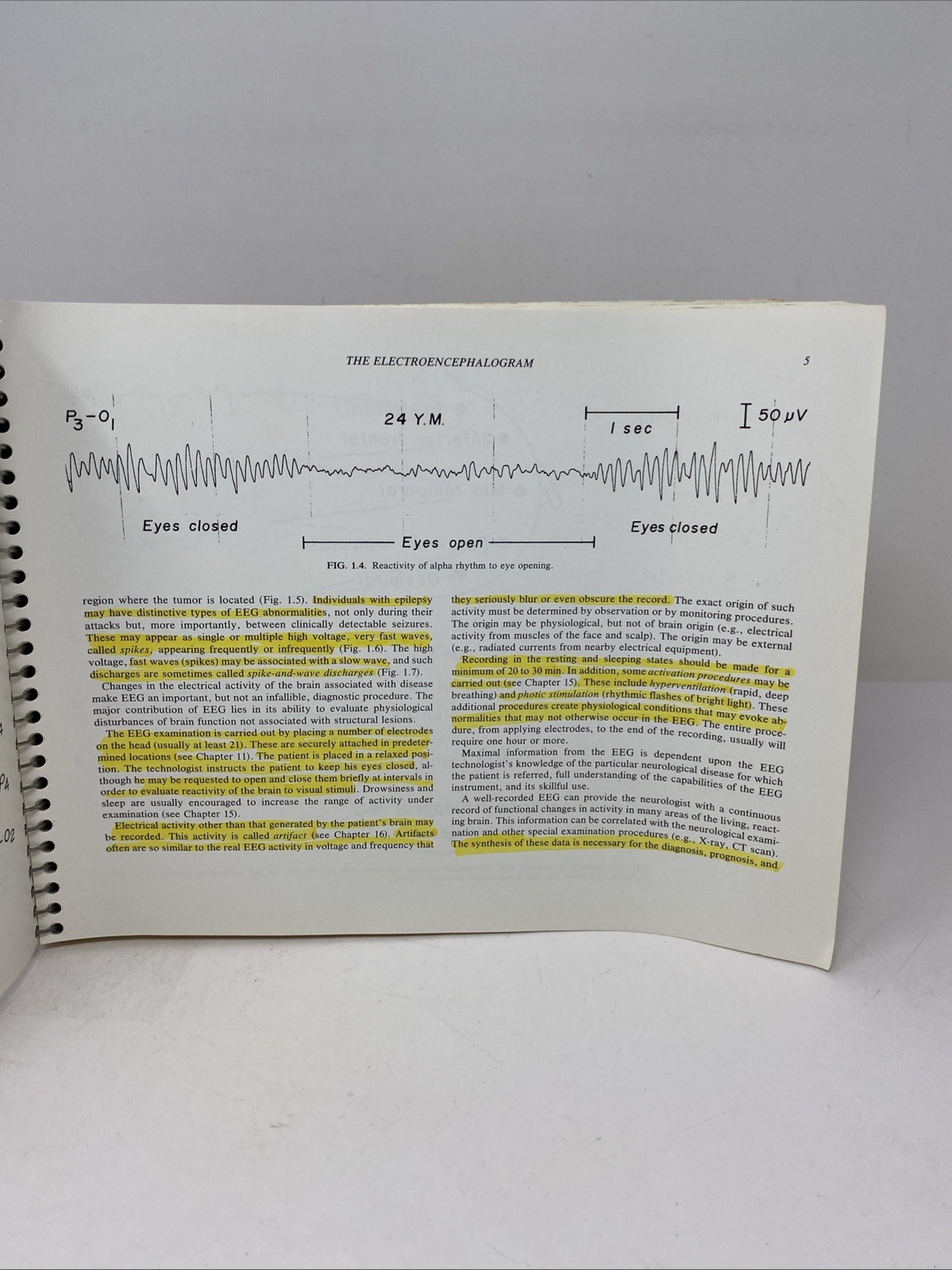 Fundamentals EEG Technology Vol 1 Tyner Spiral Bound 1985 Raven Press Lippincott