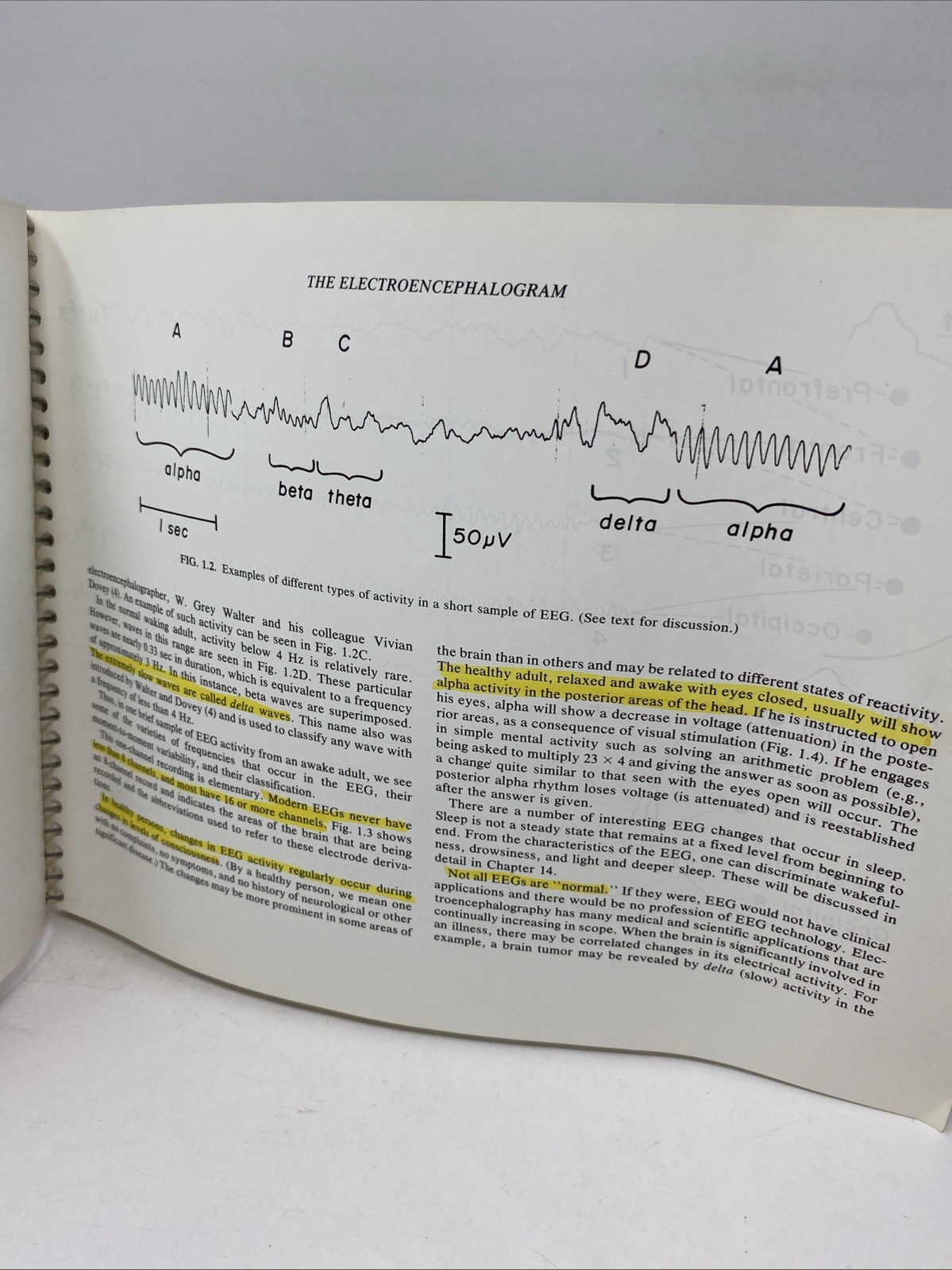Fundamentals EEG Technology Vol 1 Tyner Spiral Bound 1985 Raven Press Lippincott