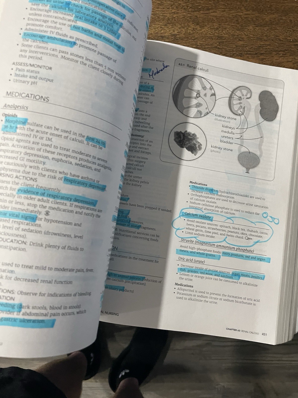 RN Adult Medical Surgical Nursing Edition 12.0 : Content Mastery