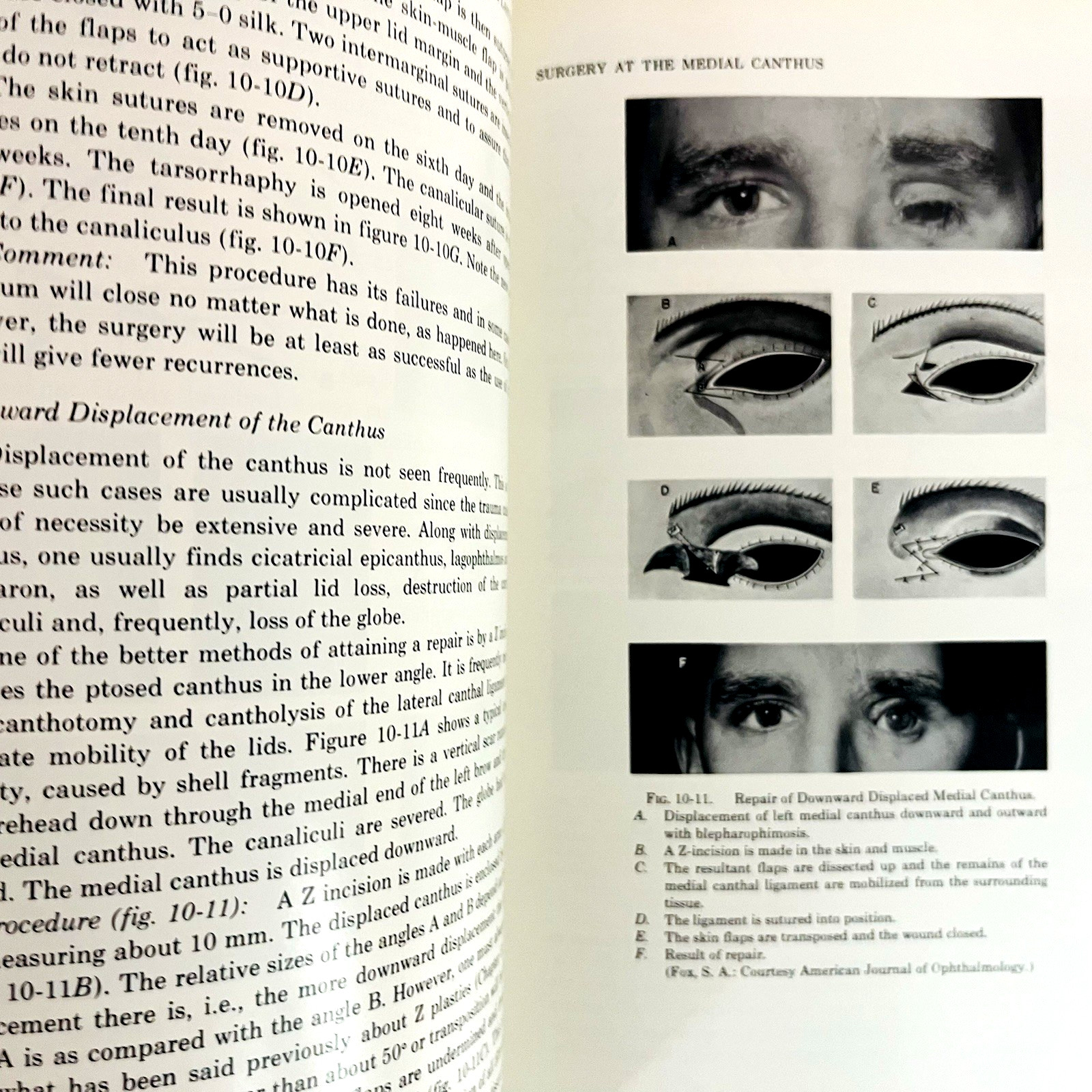 Ophthalmic Plastic Surgery Fifth Edition Book Hardcover Sidney A. Fox 1976