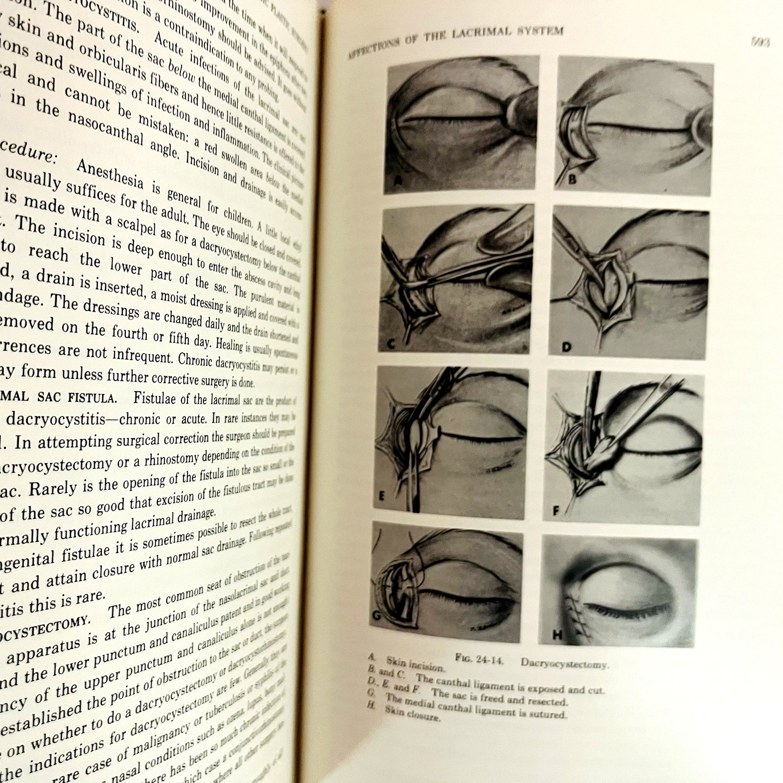 Ophthalmic Plastic Surgery Fifth Edition Book Hardcover Sidney A. Fox 1976