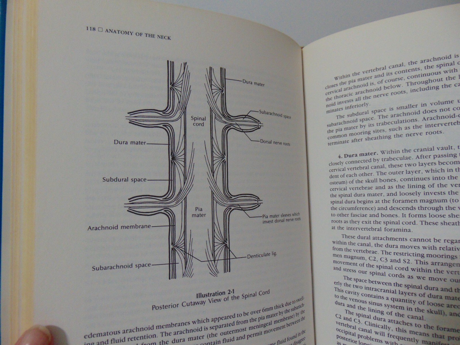 Craniosacral Therapy II: Beyond the Dura by John E Upledger Hardcover 1987