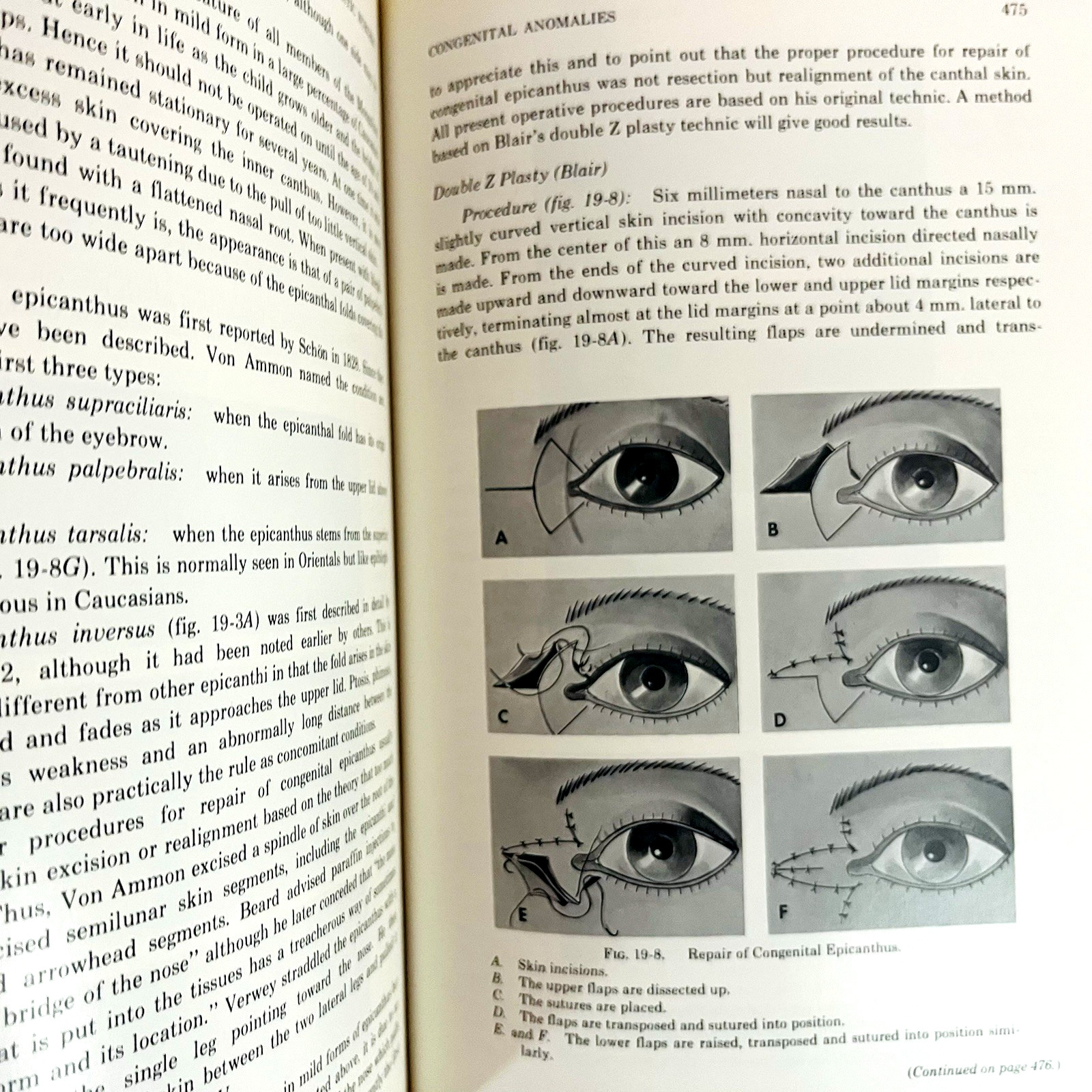 Ophthalmic Plastic Surgery Fifth Edition Book Hardcover Sidney A. Fox 1976