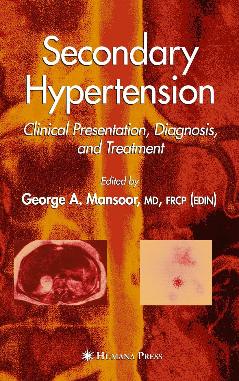 Secondary Hypertension: Clinical Presentation, Diagnosis, and Treatment (Cli…
