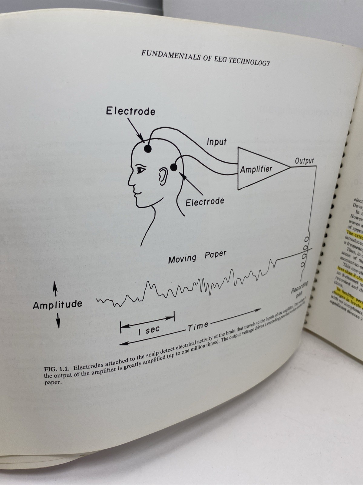 Fundamentals EEG Technology Vol 1 Tyner Spiral Bound 1985 Raven Press Lippincott