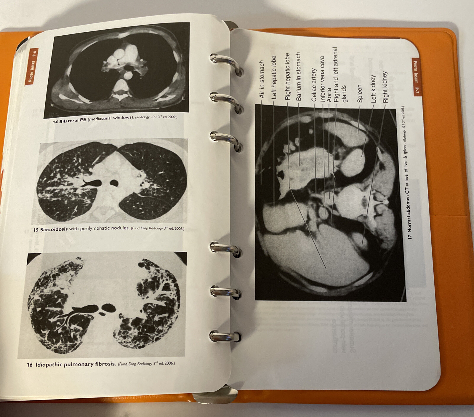 Pocket Notebook Ser.: Pocket Medicine : The Massachusetts General Hospital…