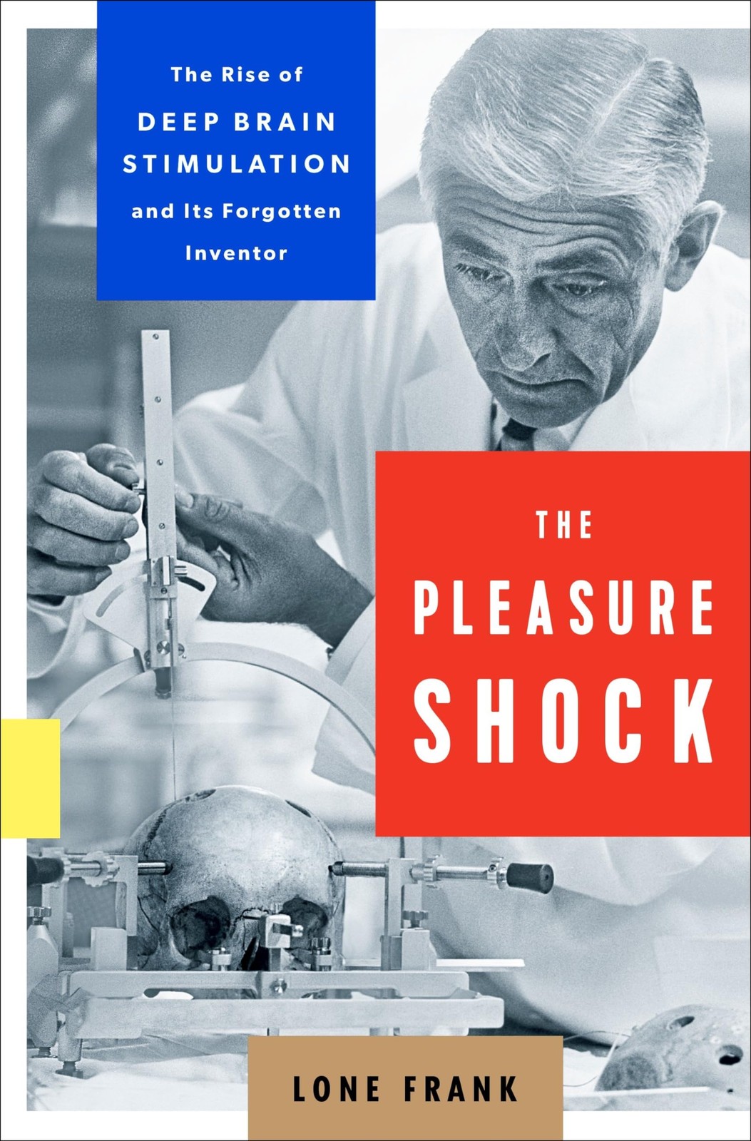 The Pleasure Shock: The Rise of Deep Brain Stimulation and Its Forgotten Inv…