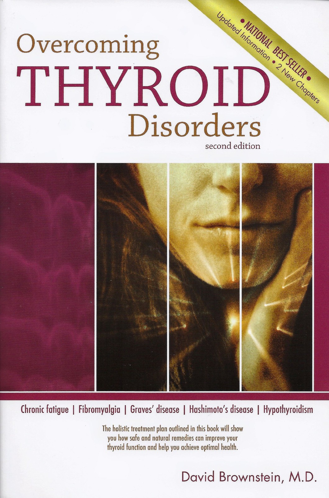 Overcoming Thyroid Disorders by Brownstein, David (2002) Paperback – paperba…