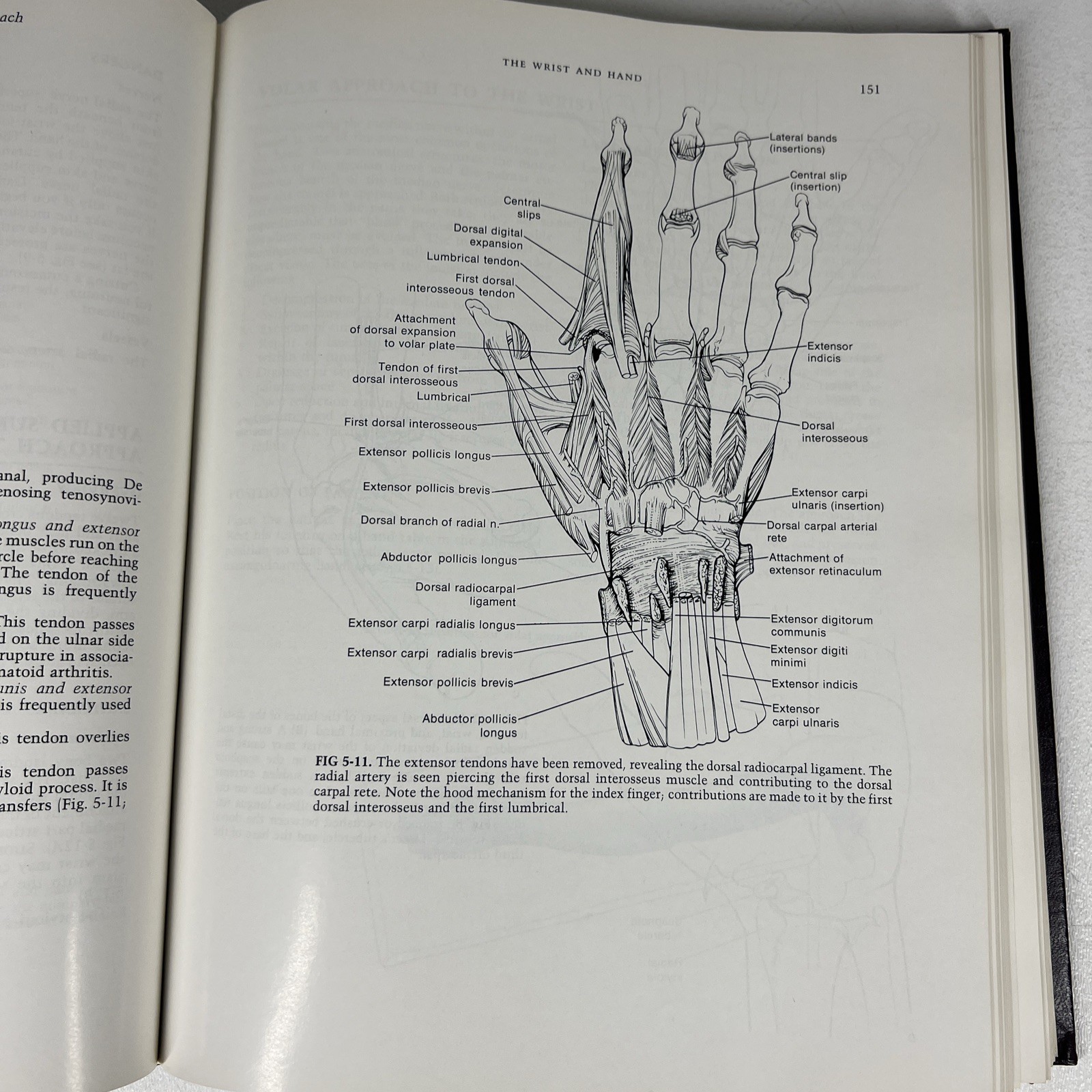Surgical Exposures in Orthopaedics Hardcover Stanley Hoppenfeld