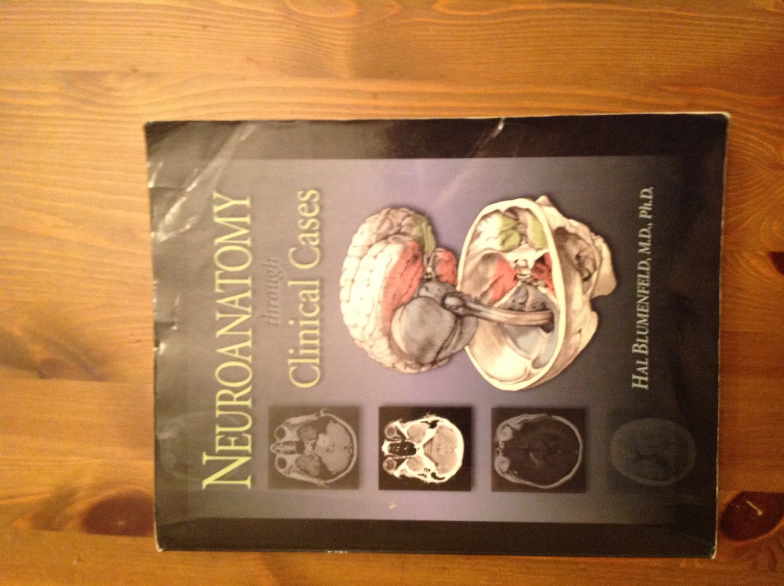 Neuroanatomy